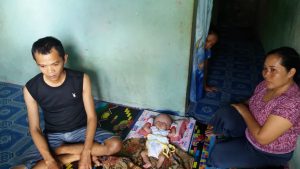 Tidak Punya Biaya Berobat, Aska Balita 40 Hari Diduga Mengidap Penyakit Hidrosefalus Hanya Dirawat Dirumah