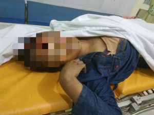 RD Diduga Jadi Korban Tabrak Lari