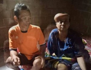 Di Diagnosa Tumor Otak, Keluarga Tak Mampu ini Butuh Bantuan Untuk Berobat.