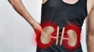 Penyakit Gagal Ginjal Kronis Memperparah Kondisi Pasien Covid-19, Bisa Berujung Kematian