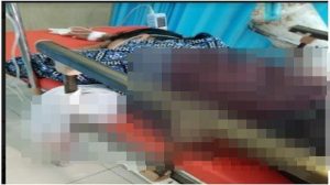 Siswi SMK Di Ogan Ilir Jadi Korban Begal, Tetap Dianiaya Meskipun Telah Serahkan Motor Dan Ponsel